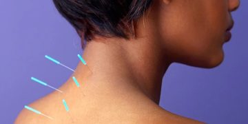 Lists of startling health benefits of Acupuncture